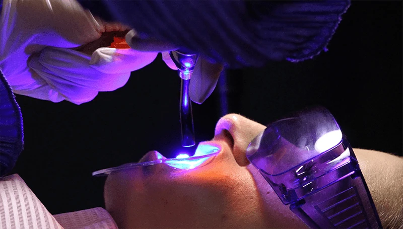 Tooth gems training course, tooth gems kit