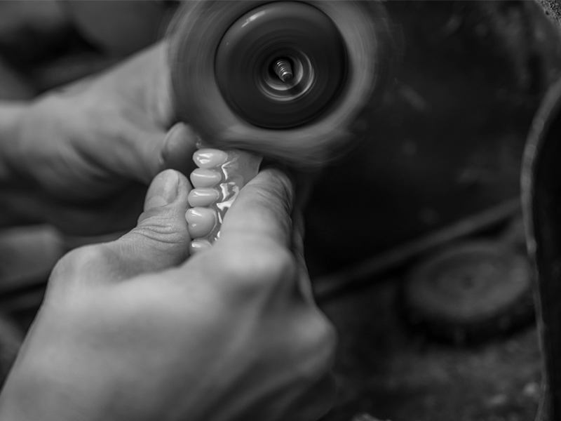 3D process of grillz customization