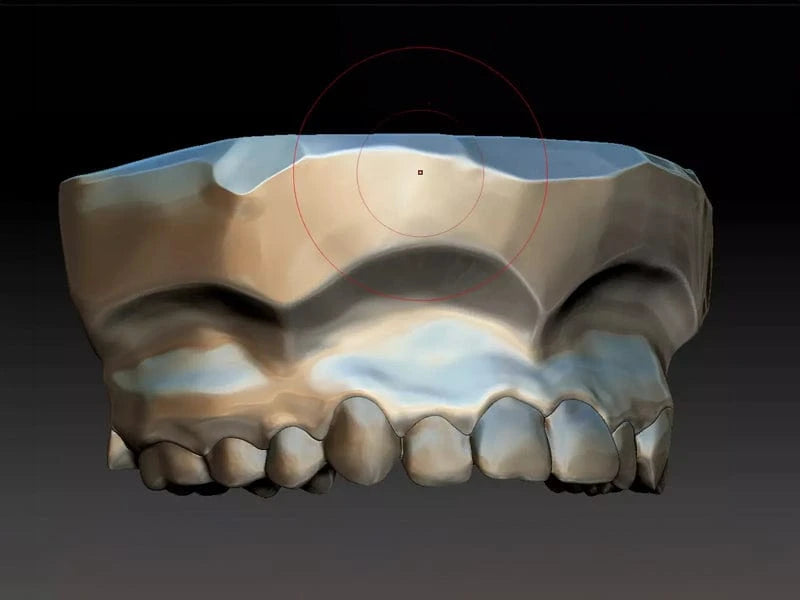 3D process of grillz customization