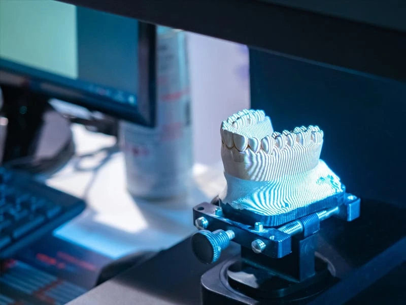 3D scan process of grillz customization