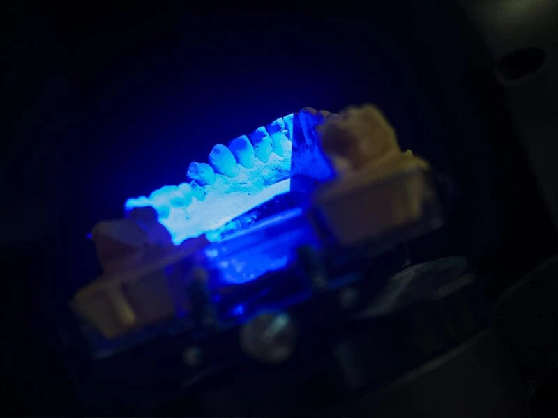 3D scan process of grillz customization